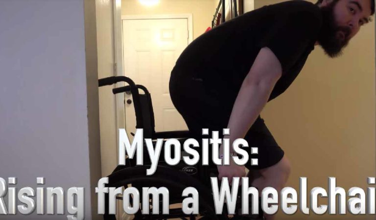 Getting Up from a Wheelchair with Myositis