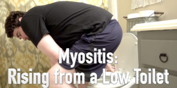 Getting up from a Toilet with Myositis