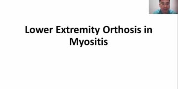Orthotics and Myositis